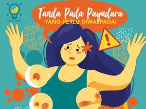 Tanda-Tanda Kanker Payudara yang Kamu Perlu Tahu