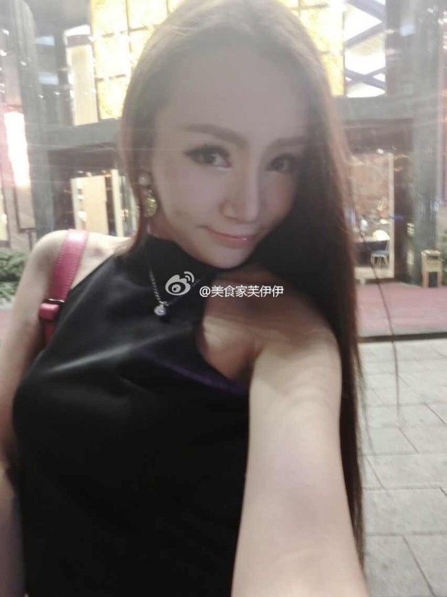 Fuyiyi terus menjalani operasi plastik dan kecanduan. Ia mengklaim bahwa semua bagian, kecuali alat kelamin, telah berada di bawah pisau bedah. Ia melakukan pembesaran payudara, rinoplasti, botox, sedot lemak, dan memutihkan kulit. Foto: dok. Weibo