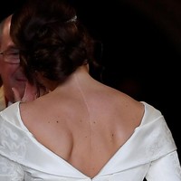 Bekas luka yang memanjang dari tengkuk ke punggung bagian atas itu didapat Eugenie dari operasi yang dijalaninya pada usia 12 tahun. Saat remaja, wanita berusia 28 tahun ini pernah bermasalah dengan skoliosis, yakni kondisi tulang belakang yang bengkok. Foto: REUTERS/Toby Melville