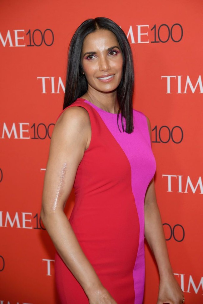 Celebrity Chef Padma Lakshmi pernah mengalami kecelakaan parah saat berusia 14 tahun, yang meninggalkan luka di sepanjang lengan kanannya. Namun dia tidak pernah berusaha menutupinya karena merupakan sebuah bagian dari sejarah hidupnya. Foto: Getty Images