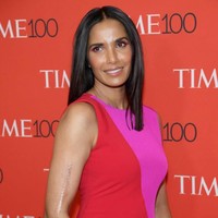 Celebrity Chef Padma Lakshmi pernah mengalami kecelakaan parah saat berusia 14 tahun, yang meninggalkan luka di sepanjang lengan kanannya. Namun dia tidak pernah berusaha menutupinya karena merupakan sebuah bagian dari sejarah hidupnya. Foto: Getty Images