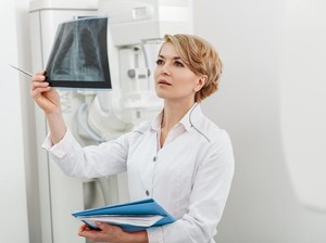 Non-Perokok Tapi Meninggal karena Kanker Paru, Dokter Jelaskan Kemungkinannya