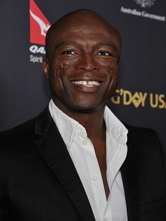 Penyanyi Seal punya bekas luka yang cukup lebar di wajahnya, akibat penyakit lupus yang dikenal dengan nama discoid lupus erythematosus. Tapi ia tetap percaya diri dengan bekas lukanya, karena suara merdunya lah yang berhasil memikat audiens. Foto: Getty Images