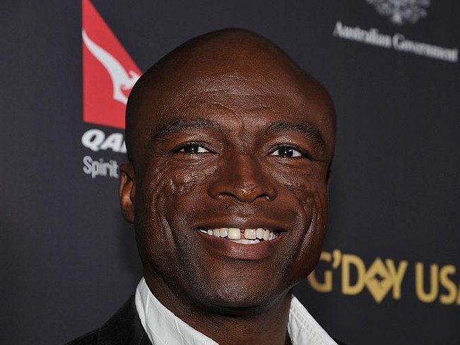 Wajah Seal yang punya banyak bekas luka sempat memubat orang mengira dia pernah mengalami kecelakaan parah. Tapi bekas luka itu ternyata akibat penyakit lupus yang dideritanya saat kecil. Discoid Lupus Erythematosus mengakibatkan peradangan, luka, jaringan parut hingga kebotakan permanen. Foto: Getty Images