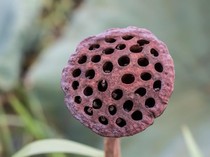 Takut Berlebihan Terhadap Sesuatu Bisa Jadi Tanda Fobia, Kenapa Bisa Terjadi?