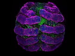 Seperti Pakai Mikroskop, Deretan Foto Mikro Ini Bikin Ngeri