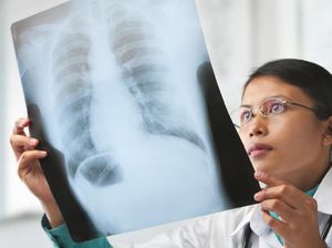 5 Pertanda COVID-19 Sudah Menyebar ke Paru-paru Pengidapnya