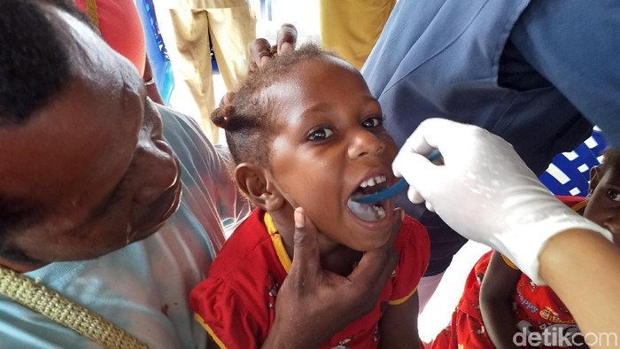 Seorang bocah di Papua minum obat cacing untuk mencegah Filariasis (Foto: detikHealth/Khadijah Nur Azizah) Seorang bocah di Papua minum obat cacing untuk mencegah Filariasis (Foto: detikHealth/Khadijah Nur Azizah)