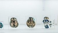 Tak cuma sebagai pajangan, spesimen otak di museum ini juga dipelajari oleh para peneliti NIMHANS. Traveler bisa berkunjung ke sini untuk mendapatkan ilmu dan pengetahuan baru terkait otak manusia. (NIMHANS)