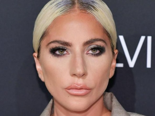 Penyayi yang baru-baru ini terjun di industri film itu secara blak-blakan pernah melakukan vermak bibir dengan harga terjangkau ketika belum punya banyak uang. Lady Gaga mengaku terobsesi melakukan injeksi cairan di wajah hingga bibirnya. Aku mendapatkan Juvederm di beberapa titik, sekarang semuanya hilang, ujar wanita yang sukses berakting di film A Star is Born itu.  Foto: Getty Images