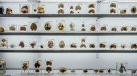 Ada lebih dari 600 spesimen otak yang ada di museum ini. Masing-masing spesimen diberi label tentang penyakit atau kelainan apa yang diderita otak tersebut, dari alzheimer, parkinson, sampai skizofernia. (NIMHANS)