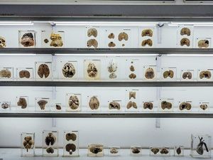 Foto: Museum Otak di India, Kalau Takut Jangan Lihat!