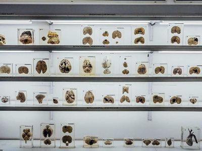 Foto: Museum Otak di India, Kalau Takut Jangan Lihat!