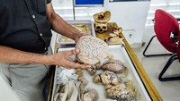 Otak-otak ini berasal dari pasien penderita penyakit/kelainan otak, yang didonasikan setelah sang pasien meninggal. Traveler bisa pegang langsung spesimen otak di museum ini. Berani nggak? (NIMHANS)