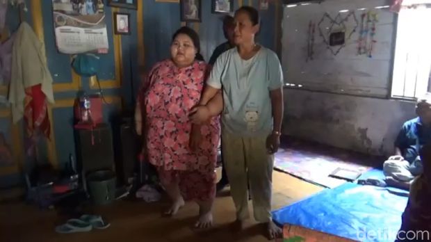 Kisah Sendu Silvia, Gadis asal Lamongan Berbobot 197 Kg