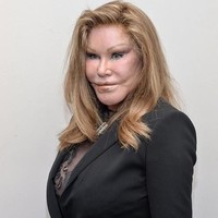 Pernyataan tersebut mengejutkan publik mengingat Jocelyn dikenal karena perubahan wajahnya yang ekstrem. Banyak orang yang tidak percaya dengan pengakuannya.  Foto: Getty Images