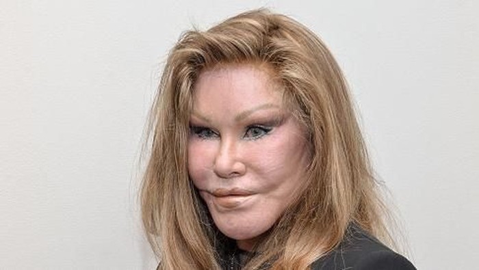 Sosialita Jocelyne Wildenstein Meninggal saat Tidur Siang, Inikah Pemicunya?