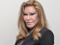 Wajah Sosialita yang Gila Operasi Plastik, Berubah Drastis dari Sebelum Oplas