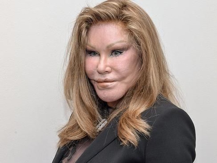 Jocelyn Wildenstein NEW YORK, NY - OCTOBER 08: (EXCLUSIVE COVERAGE) Jocelyn Wildenstein attends the Jean-Yves Klein: Chimeras Exhibition at Gallery Molly Krom on October 8, 2015 in New York City. (Photo by Grant Lamos IV/Getty Images)