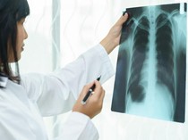 Video: Istana Pastikan Uji Klinis Vaksin TBC Bill Gates Aman