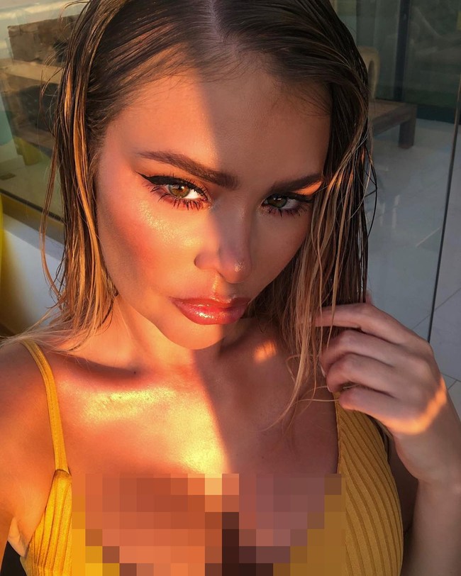 Chloe mengaku bahwa dia telah melakukan operasi pembesaran payudara sebanyak dua kali. Di 2016, Chloe mangaku menyesal melakukan implan payudara, namun tampaknya dia bangga dengan asetnya tersebut.  Foto: Instagram