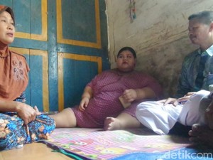 Heboh Gadis Lamongan Berbobot 179 Kg, Aria Bocah Tergemuk Pernah Lebih Gemuk