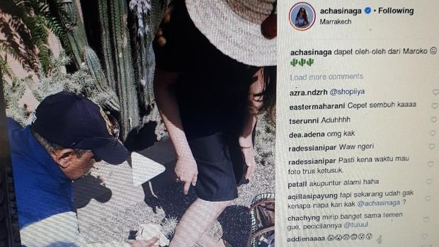 Apes! Niat Foto OOTD, Kaki Acha Sinaga Malah Kena Kaktus