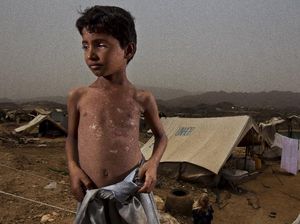 Dokter Bekasi di Perang Yaman