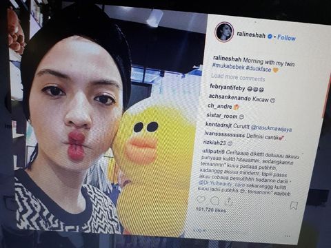 Gemes! Pose Duck Face Raline Shah Tetap Cantik