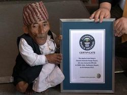 Potret Mengejutkan Mereka yang Menjadi Terkecil di Dunia