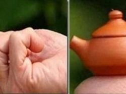 Potret Mengejutkan Mereka yang Menjadi Terkecil di Dunia