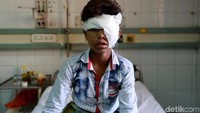 Seorang anak terluka di bagian kepalanya. REUTERS/Adnan Abidi.