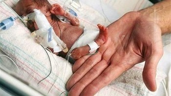 Bayi prematur paling kecil, di tahun 2016 bayi perempuan ini terpaksa harus lahir setelah hanya 26 minggu di dalam rahim. Bayi ini memiliki berat hanya 8 ons dengan tinggi 8,6 inci.  (Foto: list25)