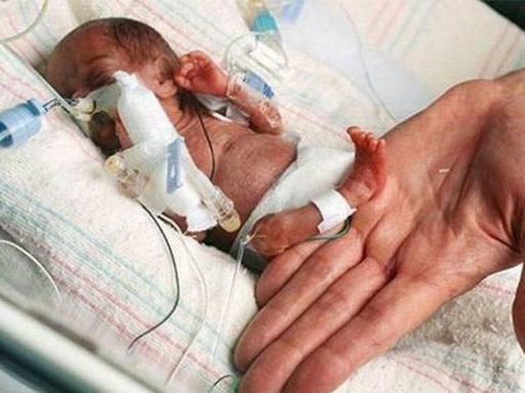 Potret Mengejutkan Mereka yang Menjadi Terkecil di Dunia