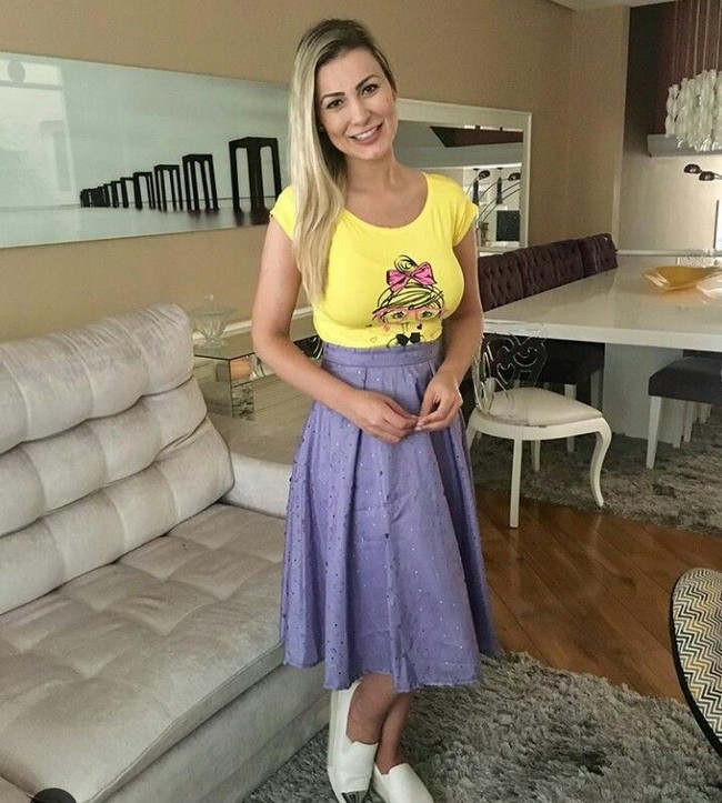 Kisah pilunya yang hampir membuatnya tewas itu terjadi di 2015. Wanita asal Brazil itu mengalami infeksi parah di sekitar bokong hingga kakinya setelah dokter menyuntikkan cairan hydrogel. Foto: Dok. Instagram Andressa Urach