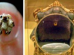 Potret Mengejutkan Mereka yang Menjadi Terkecil di Dunia