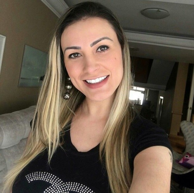 Prosedur tersebut ternyata membuat otot-otot kakinya membusuk. Hasilnya, paha pada bagian sampingnya hingga bokongnya menjadi bolong dan meninggalkan luka sampai membusuk. Foto: Dok. Instagram Andressa Urach