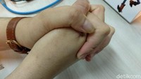 Lain lagi kalau kamu suka menggenggam tangan seperti ini. Mungkin saja kamu itu jomblo, makanya nggak ada yang gandeng. Foto: Widiya Wiyanti/detikHealth