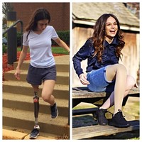 Berbagai media pernah memberitakan ibu dua anak ini. Ia bahkan tampil di televisi, seperti Fox. Kaki prostetik ini adalah bagian dariku, dan itulah diriku, ujarnya. Foto: Instagram @tessnyder