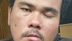 Ini Kondisi Terkini Fahmi Bo Usai Terkena Stroke