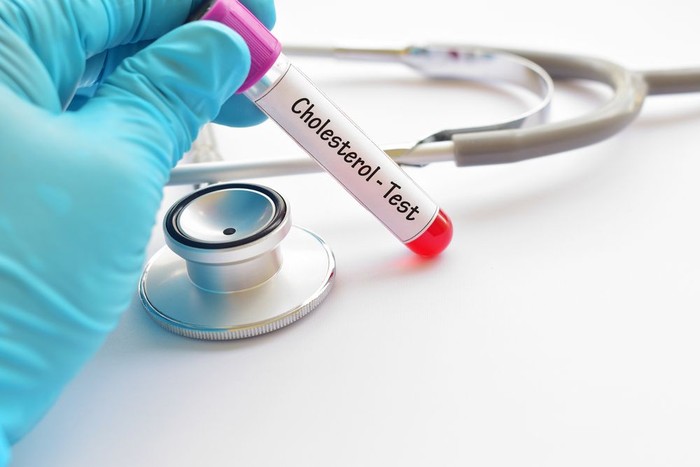 Yuk, Cegah Risiko Stroke dengan Atur Kadar Kolesterol