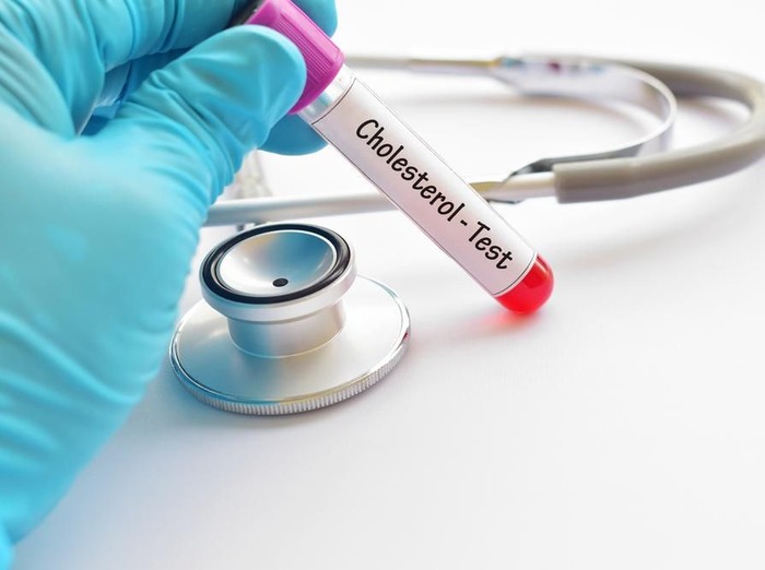 9 Cara Menurunkan Kolesterol Secara Alami Tanpa Obat Foto: shutterstock 9 Cara Menurunkan Kolesterol Secara Alami Tanpa Obat Foto: shutterstock