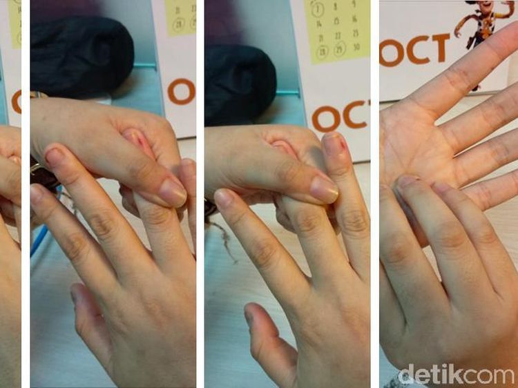 Pusing karena Kelelahan? 5 Teknik Pijat Praktis Ini Bisa Meredakannya