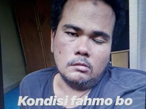 Seperti Fahmi Bo, 6 Artis Indonesia Ini Berjuang Hadapi Serangan Stroke