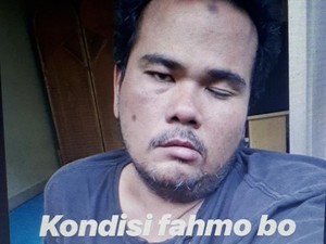 Seperti Fahmi Bo, 6 Artis Indonesia Ini Berjuang Hadapi Serangan Stroke