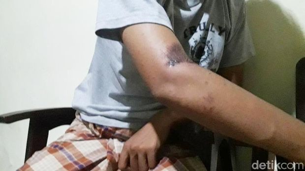 Cerita Shendy, Korban Begal yang Sempat Dibacok Hingga Dibuang