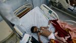 Potret Mengenaskan Anak-anak Yaman Akibat Konflik Berkepanjangan
