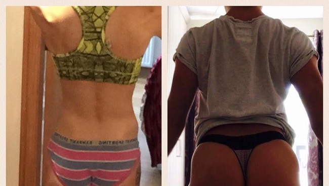 Berat badannya turun jauh di bawah 38 kg, dan tubuhnya hanyalah tulang yang dibungkus dengan kulit. Emily pun menggambarkan gangguan makannya sebagai setan kecil yang mengambil alih tubuhnya. Foto: Instagram