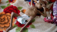 Lembaga kemanusiaan Save the Children melaporkan bahwa jumlah bocah yang menghadapi risiko kelaparan di Yaman telah mencapai 5,2 juta orang akibat konflik berkepanjangan di negara tersebut. Foto: Reuters