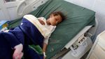 Potret Mengenaskan Anak-anak Yaman Akibat Konflik Berkepanjangan